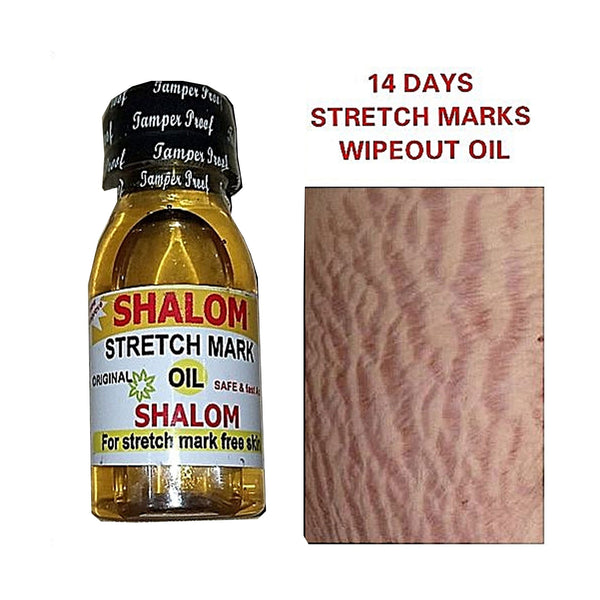 Shalom Stretch Marks Oil